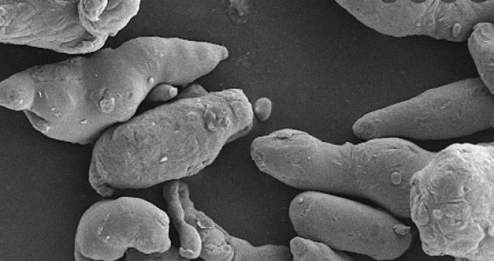 Nodular Aluminum Powder